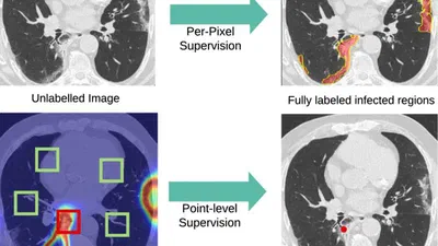A Weakly Supervised Region-Based Active Learning Method for COVID-19 Segmentation in CT Images featured image