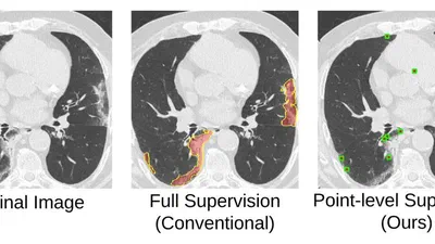 A Weakly Supervised Consistency-Based Learning Method for COVID-19 Segmentation in CT Images featured image