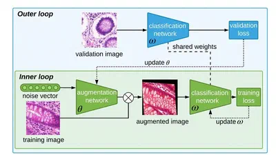 Automatic Data Augmentation Learning using Bilevel Optimization for Histopathological Images featured image