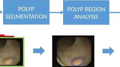 A Benchmark for Endoluminal Scene Segmentation of Colonoscopy Images featured image